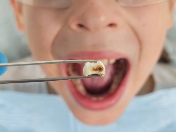 Best Knocked-Out Tooth Emergency  in Ignacio, CO